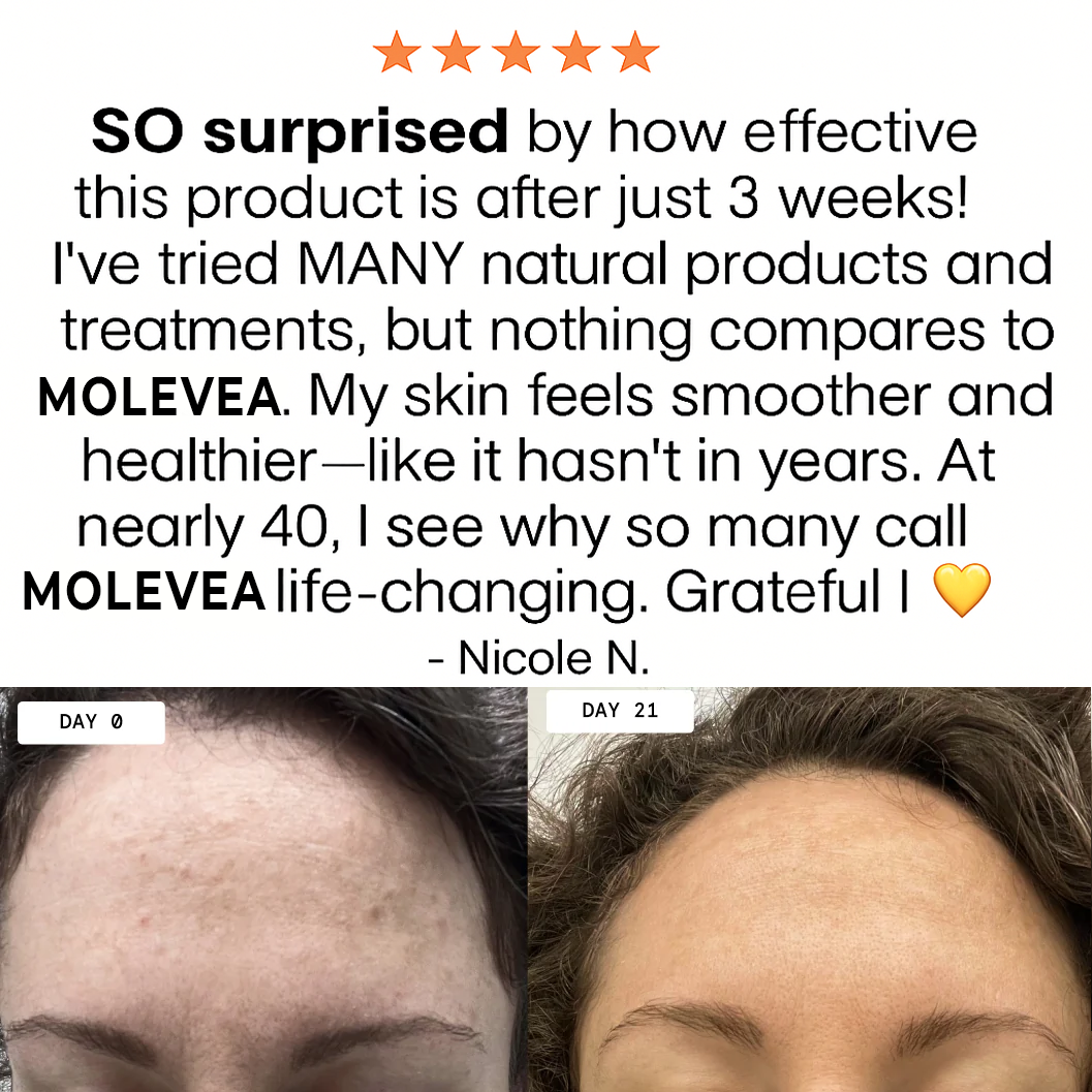 Dual Retinoid Complex 0.2 Molevea