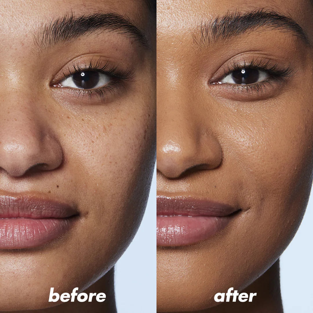 Dual Retinoid Complex 0.2 Molevea