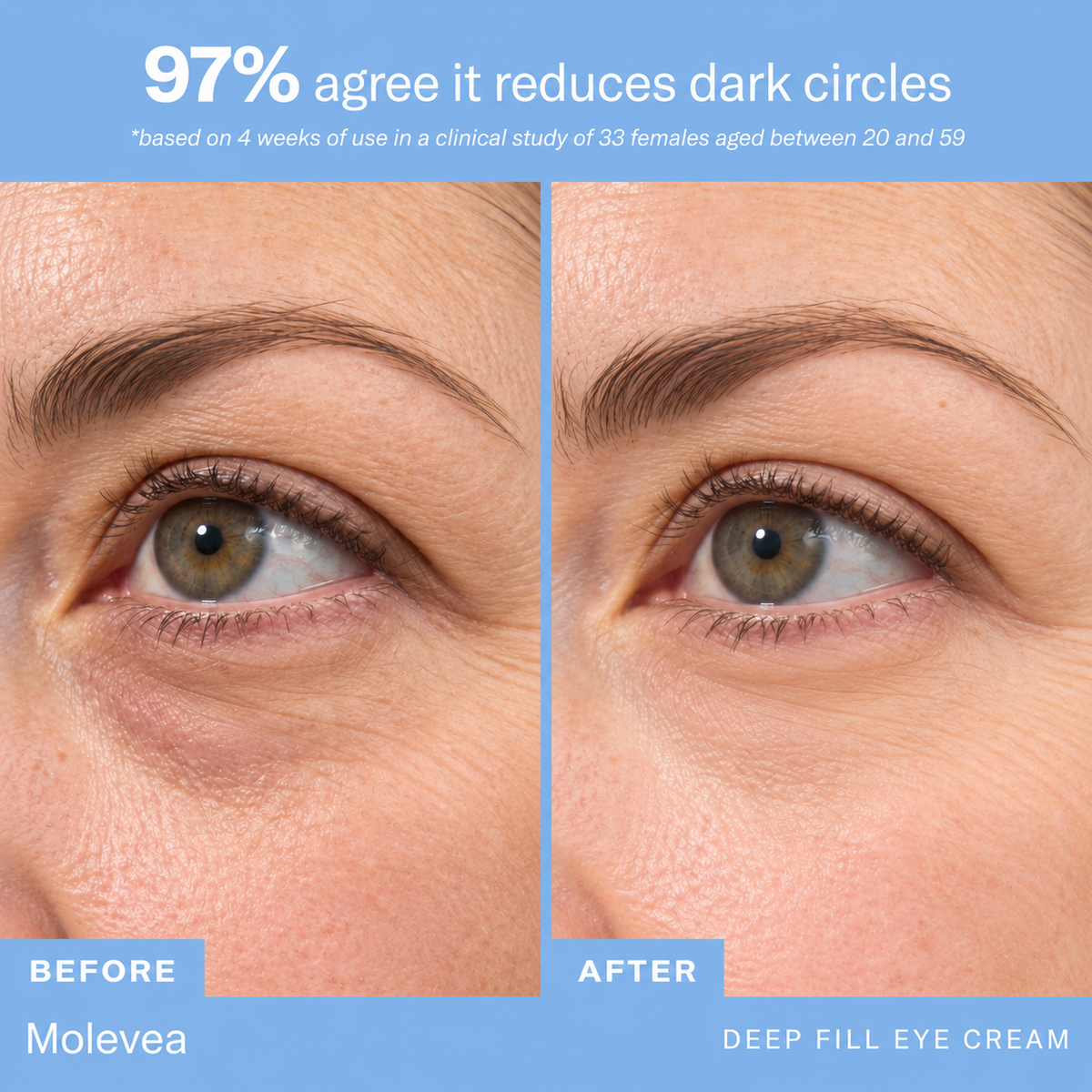 Molevea Fill Eye Cream