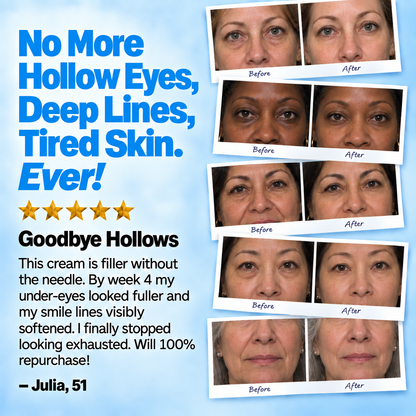 Molevea Fill Eye Cream