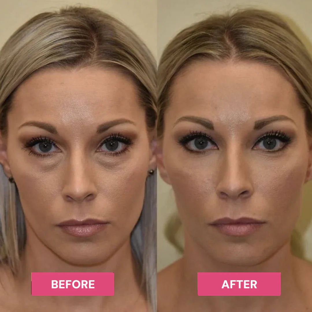 PDRN Pink Caffeine Collagen Eye Patches