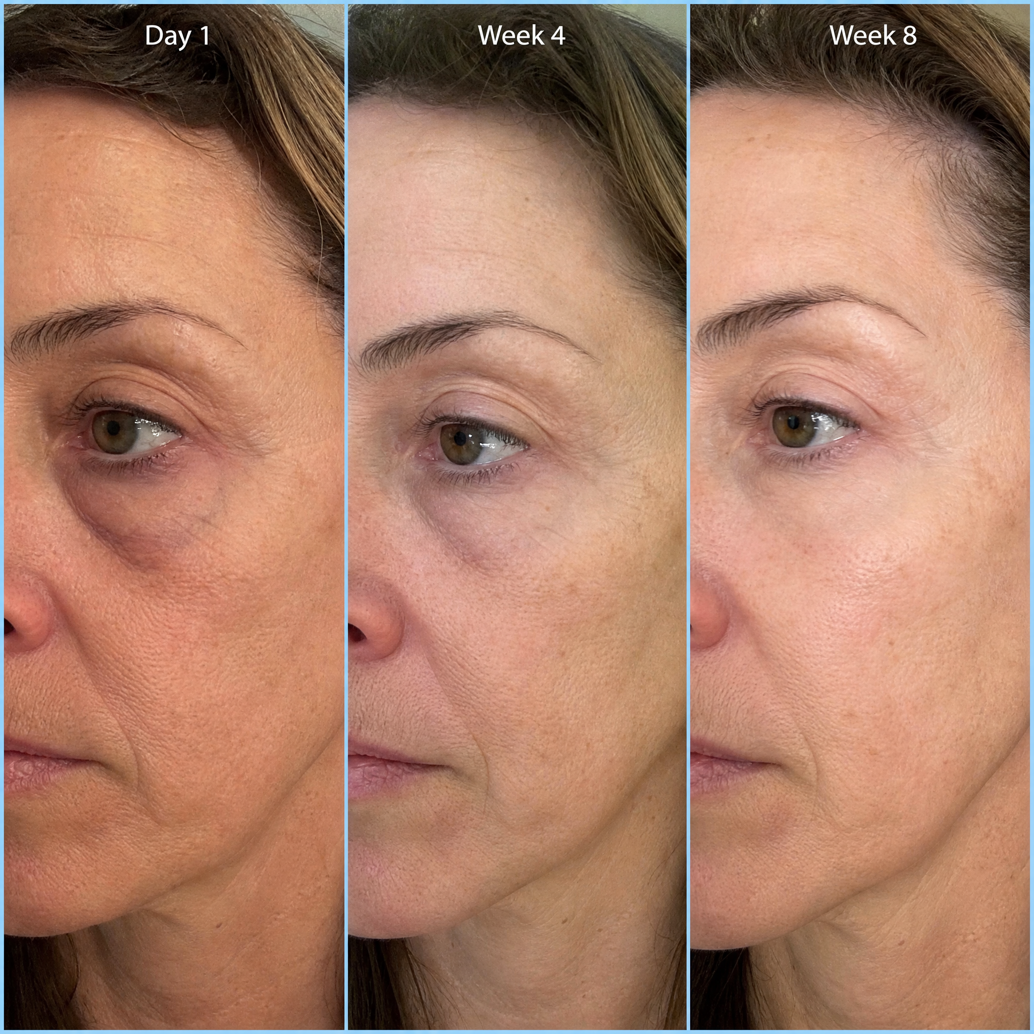 Deep Fill Eye Cream 90-day results timeline