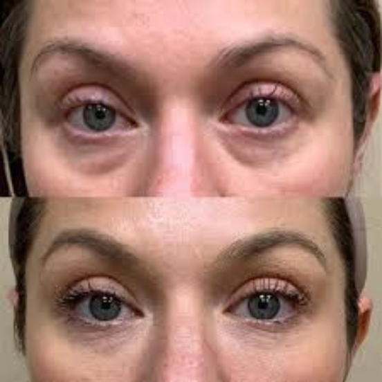 Molevea Fill Eye Cream